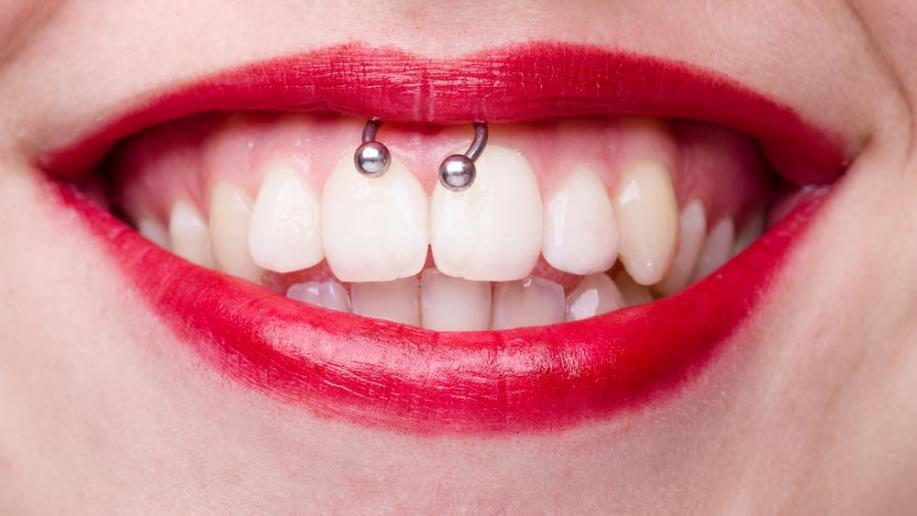 الثقب المبتسم له عواقب على صحة الفم والأسنان