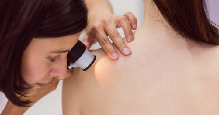 dermatoscope