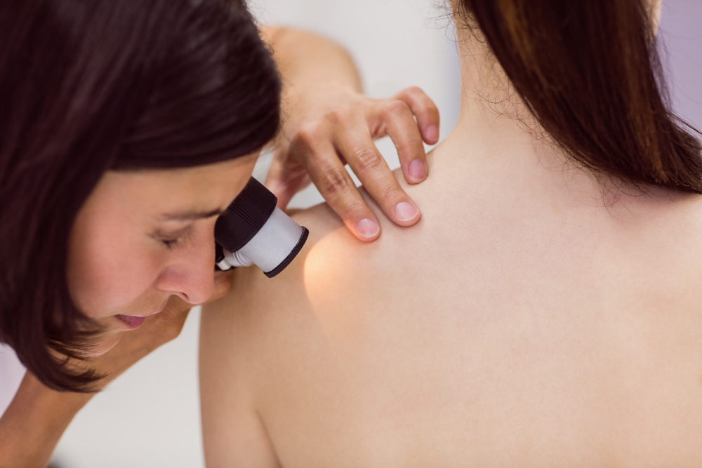 dermatoscope